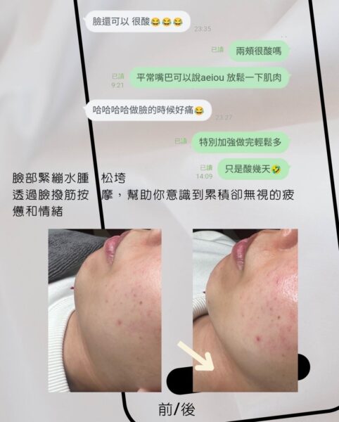 員林做臉推薦好評