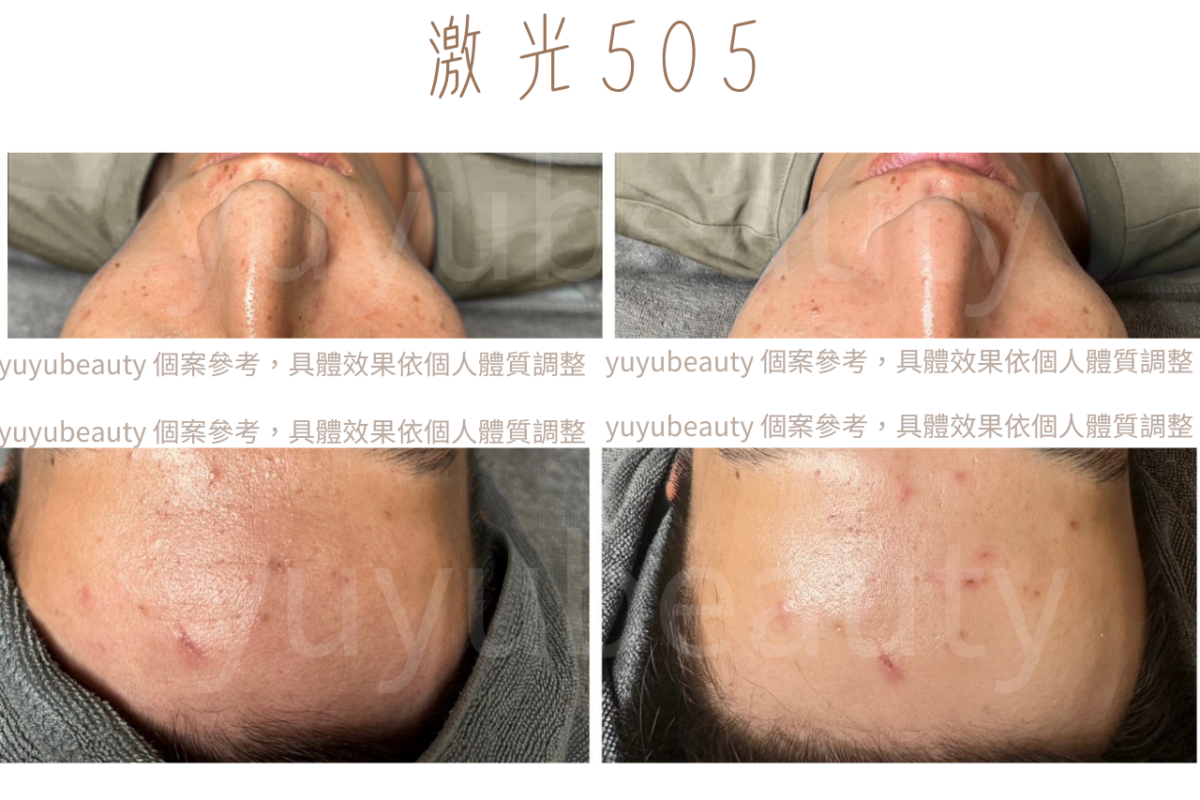 員林做臉推薦-悠悠工作室作品見證